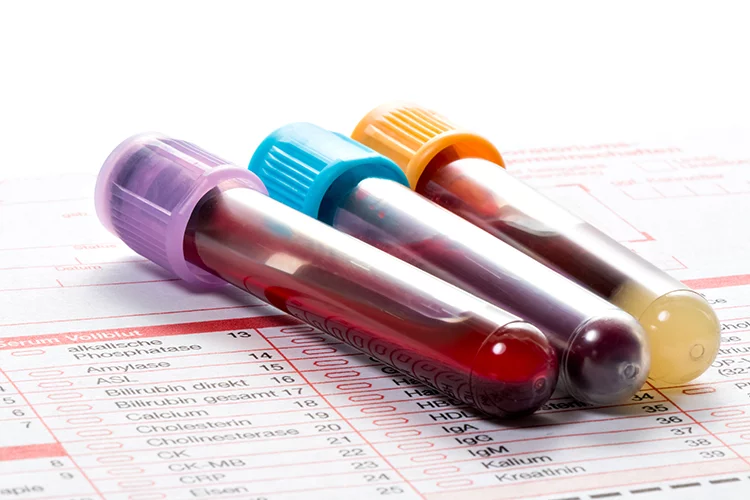 Blutproben für eine ausführliche Labordiagnostik in der Tierheilpraxis Mattes.